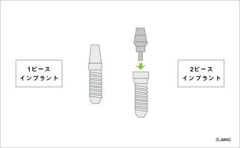 1ピースインプラントと2ピースインプラントのイメージ図